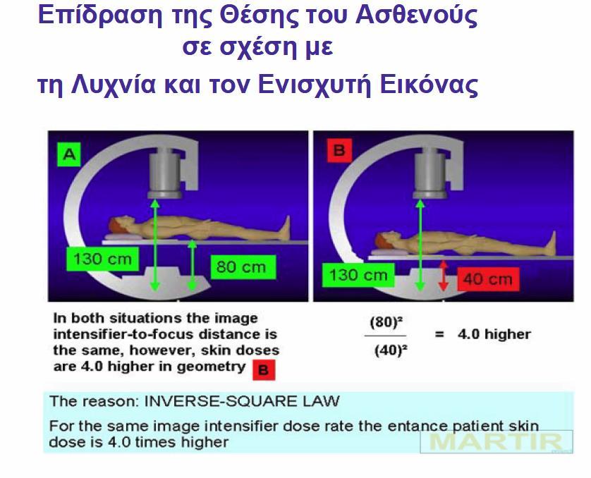 Ακτινοσκόπηση :