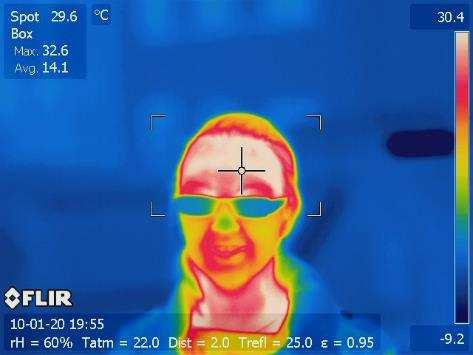 mjerenja je termogram, On u sivim tonovima ili nekom kodu boja daje