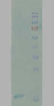 ].[.. A % G+C A. (%/).[ ] HindIII. PCR EcoRI.[] A.[] PCR pet28a.. pet32a.[] toxc. A.[ ] A.