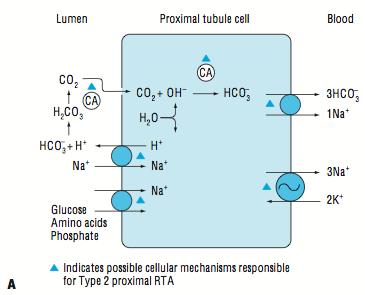 ACIDOZE METABOLICE HIPERCLOREMICE ACIDOZELE RENALE TUBULARE TIP II Consecinţele acestui tip de afectare tubulară sunt: a) scăderea reabsorbţiei tubulare de HCO 3 : pierderea urinară de HCO 3 și