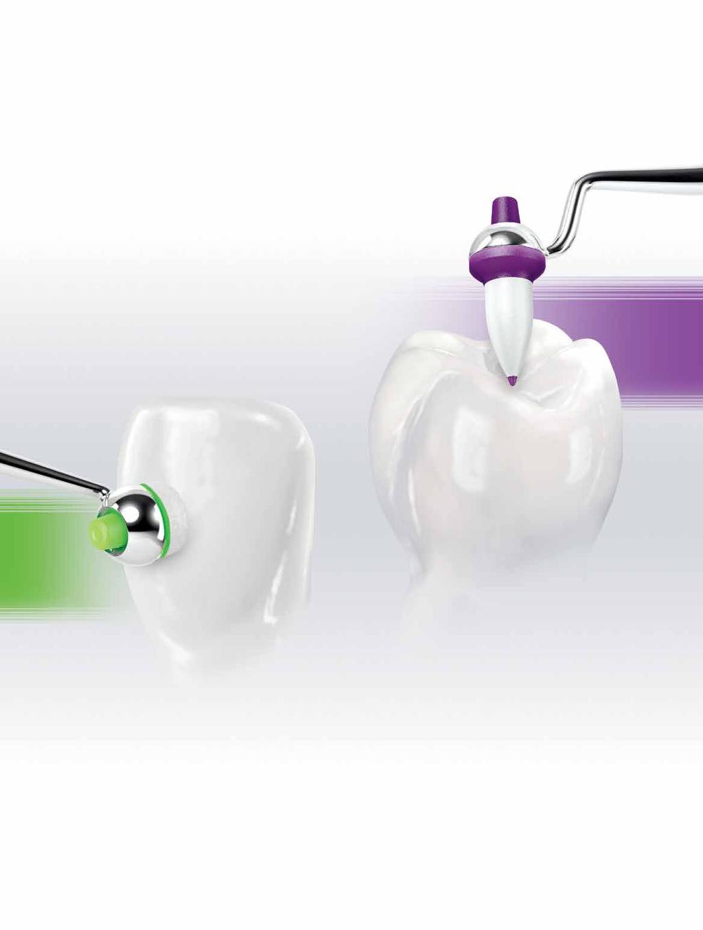 Dental Tribune Greek Edition 39 OptraSculpt Αποτελεσματική διαμόρφωση ρητινών Εξοικονόμηση χρόνου κατά τη διαμόρφωση χάρη στην αντικολλητική ιδιότητα Εύκολη προσαρμογή: χάρη στην αντικολλητική