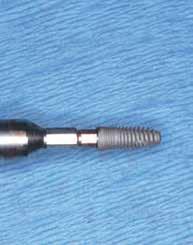 SDR Plus Στην Dentsply Sirona, αναζητάμε πάντα τρόπους για να κάνουμε τα καινοτόμα προϊόντα μας ακόμη καλύτερα.