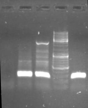 3.2. Αποτελέσματα PCR για την ενίσχυση του γονιδίου β-γλοβουλίνης με εκκινητές GH20/PCO4 Τα δείγματα στη συνέχεια στάλθηκαν στο Εργαστήριο Μοριακής Βιολογίας του Πανεπιστημίου Θεσσαλίας και