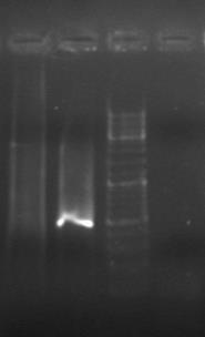 3.3. Αποτελέσματα PCR με εκκινητές PGMY09/11- HMB01 Στη συνέχεια, τα δείγματα υποβλήθηκαν σε PCR με εκκινητές το ζεύγος PGMY09/11- HMB01 για να καθοριστεί η παρουσία του