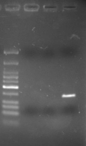 3.5. Αποτελέσματα Νested PCR με εκκινητές GP5+/6+ Στα προϊόντα των 2 προηγούμενων PCRs, εφαρμόστηκε μία Νested PCR με εκκινητές τους GP5+/6+ των οποίων το προιόν ενίσχυσης έχει