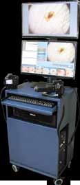 Fractional scanner κατασκευής ecomed Ταχύτητα σάρωσης 500Hz Full face resurfacing 5-6 λεπτά ιάµετρος spot 80µm 6 διαφορετικές πυκνότητες σάρωσης 10 επίπεδα ισχύος για κάθε πυκνότητα ιάρκεια παλµού