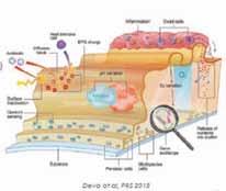 Για την πρόληψη της δημουργίας biofilm, θα πρέπει να τηρούνται ευλαβικά οι κανόνες ασηψίας: να πλένονται καλά τα χέρια του ιατρού που θα πραγματοποιήσει την έγχυση, να γίνεται προετοιμασία με