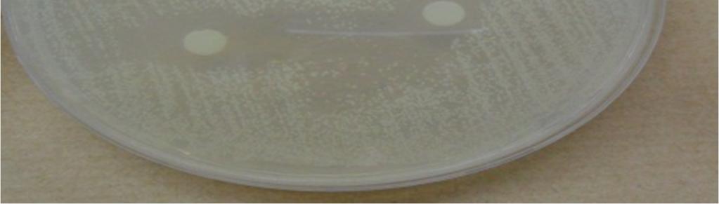 aureus ATCC 25923 : ﺑﱰﻛﻴﺰ.% 20 ب S.
