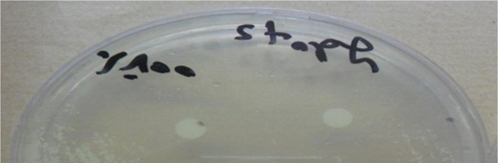 aureus ATCC 25923 : ﺑﱰﻛﻴﺰ.% 100 د E.