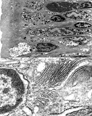 Microscopía Electrónica de Transmisión (TEM) Introdución Aplicacións SERVIZO DE MICROSCOPÍA ELECTRÓNICA O microscopio electrónico de transmisión utiliza un feixe de electróns que é conducido a través