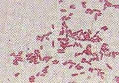 Microscopia óptica