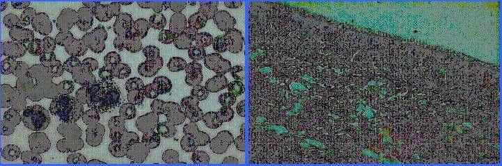 Microscopio de campo claro É o microscopio óptico composto utilizado na maioría dos laboratorios.