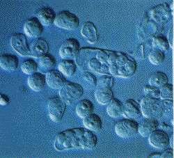Microscopio de contraste diferencial de interferencia (DIC) é