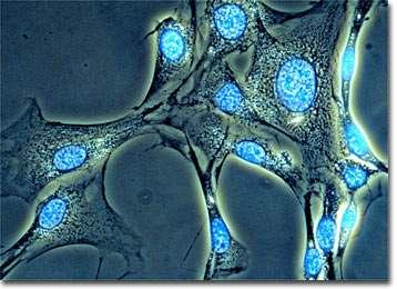 Microscopía de fluorescencia.