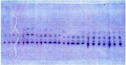 Gel de poliacrilamida tinguido con azul de Coomassie Por exemplo as proteínas poden visualizarse