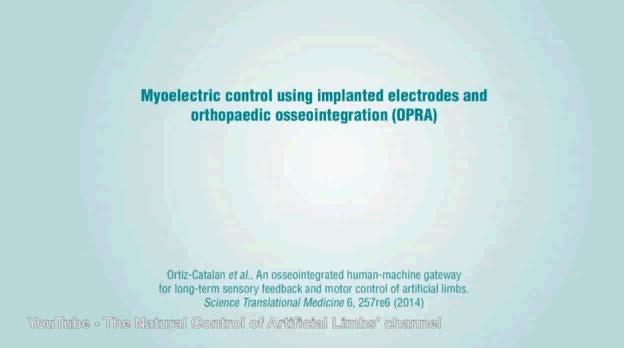 Artificial Limbs Controlled by Brain! http://www.dailymail.co.