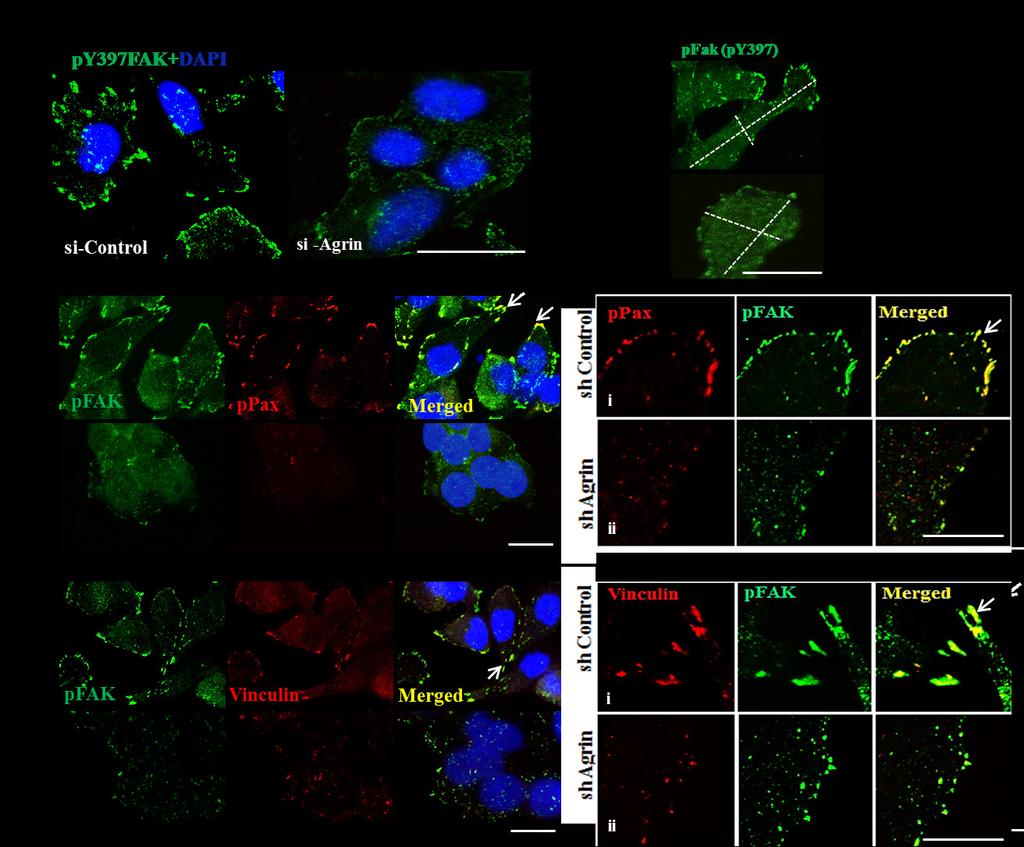 Supplementary Figure 8: Regulation of focal adhesion integrity by Agrin in HCC cell lines.