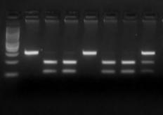 IL1B-511*1 (παρουσία κυτοσίνης-c στη θέση -511 του υποκινητή του γονιδίου της IL-1B): στην περίπτωση αυτή το περιοριστικό ένζυμο Ava I τέμνει το προϊόν της PCR σε ένα σημείο, οπότε προκύπτουν 2