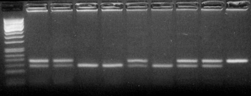 M 1 2 3 4 5 6 7 8 9 99 bp 83 bp Ηλεκτροφόρηση σε 4% πηκτή αγαρόζης του προϊόντος PCR της IL-1a (-889) μετά από πέψη με το περιοριστικό ένζυμο Nco I.