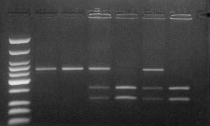 Όγκος Τελική συγκέντρωση PCR product 30.00 μl Ένζυμο Mwo I (5u/μl) 1.00 μl 0.13u 10x NE Buffer 3 4.00 μl 1x ddη 2Ο 5.00 μl - Τελικός όγκος (V ΤΕΛ) 40.
