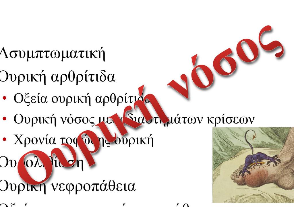 τοφώδης ουρική Ουρολιθίαση Ουρική νεφροπάθεια Οξεία αποφρακτική