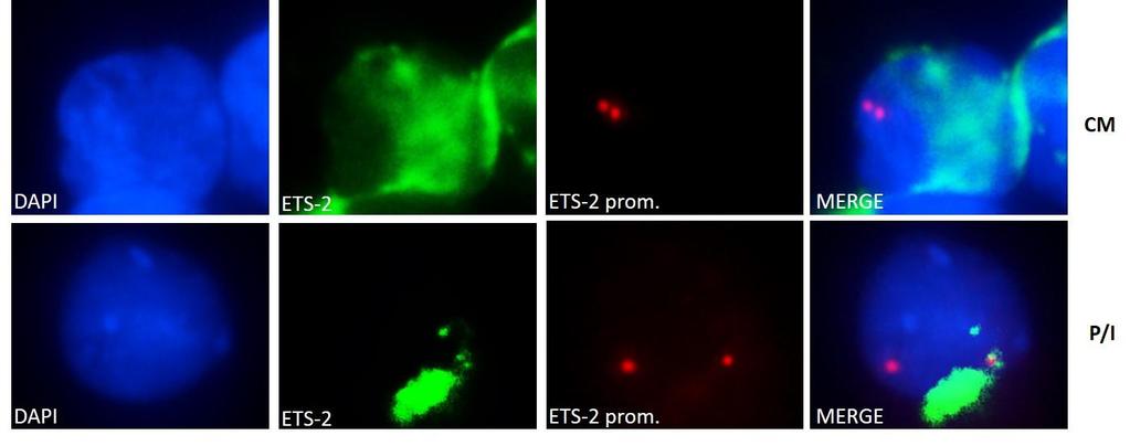 όχι σε αυτόν του Ets-2, ενώ αντίθετα όταν τα κύτταρα ενεργοποιούνται, τα πρωτεινικά επίπεδα του Ets-2 πέφτουν σημαντικά, σταματάει να προσδένεται στον υποκινητή της IL-2 και προσδένται στον υποκινητή