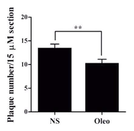 total Aβ and Aβ