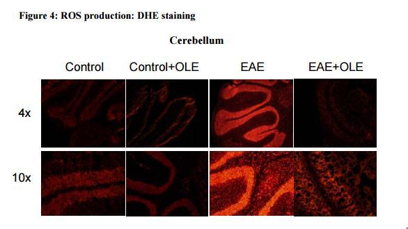 Animal model: Experimental autoimmune encephalitis (EAE) induction 10 mg/kg/day, i.