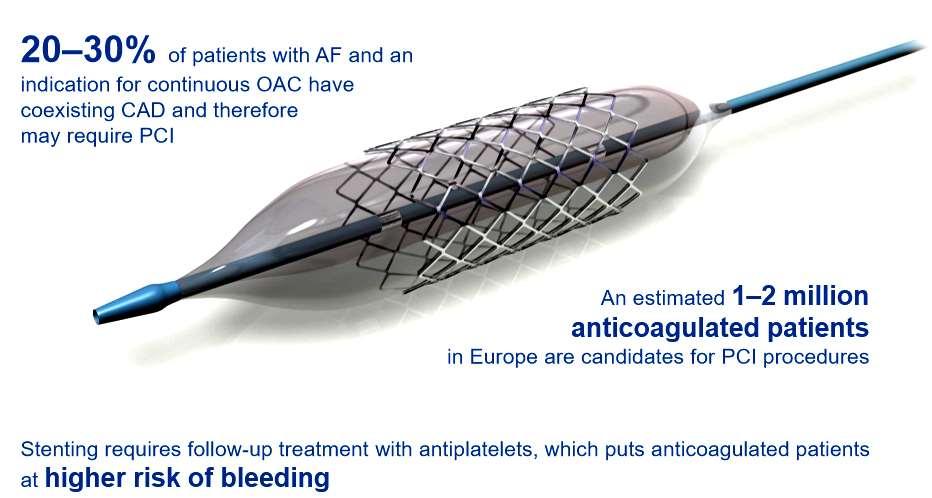 PCI AND AF Lip et al.