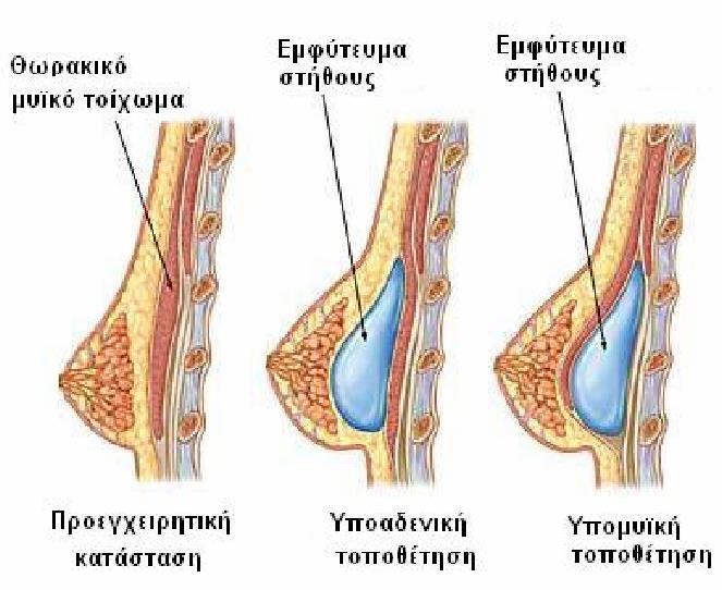 Πολυμερή