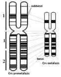 numărul cromozomului implicat (de ex..: 47, XX, +21 (trisomia 21); 47,XY,+13 (trisomia 13); 45,XX,-8 (monosomia 8); etc.