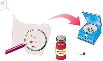 Extragerea ADN din celule nucleate Restricţia ADN genomic cu ER Electroforeza FR Denaturarea ADN şi transferul FR pe membrane Hibridare cu sonda