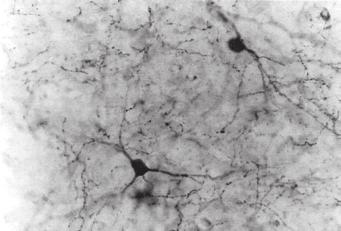 nukleo kakotuko NPY-neuronetan agertzen diren hartzaile espezifikoen bitartez. Leptinaren eta NPY eta melanokortinen arteko 5.2 irudiak adierazten du.