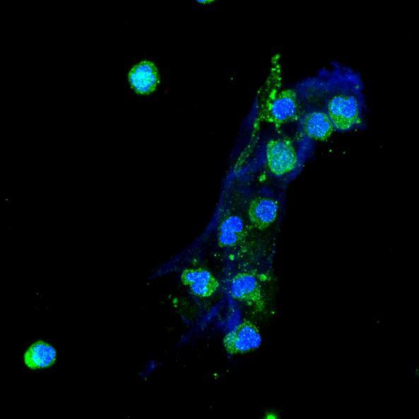 Συνεστιακή μικροσκόπηση (IF για TF/DAPI) TF/