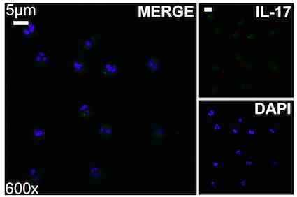 TF/DAPI και TF/NE/DAPI) σε