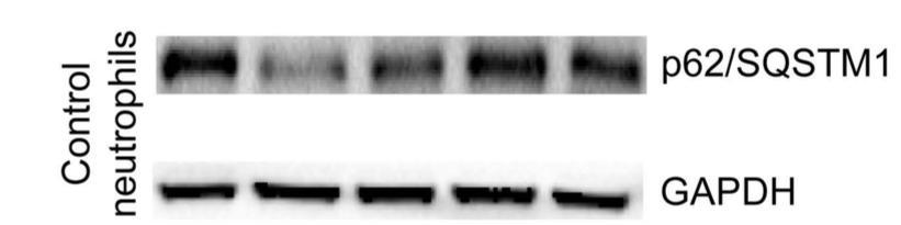 qpcr για REDD1 Γ.