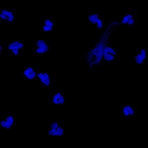 DAPI DAPI LC3 LC3 LC3 Healthy PMNs (NN) Active SLE PMNs (LN) Treated SLE PMNs (LNtr) B.