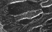 Το ενδοφλέβια χορηγούµενο 3H Ezetimibe εντοπίζεται στις ψηκτροειδείς παρυφές του εντέρου σε αρουραίους µε καθετηριασµό του
