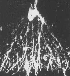 MRI -Druge