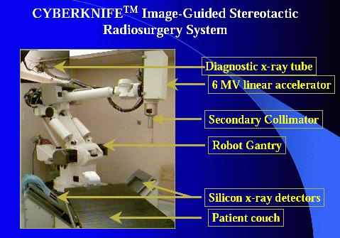 дишно синхронизирана радиотерапија, радиотерапија со следење на туморот и стереотектична операцја/радиотерапија.