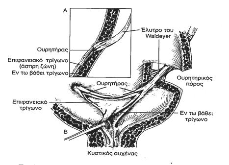 του τελικού ουρητήρα και του τριγώνου, αποφράσσουν το ουρητηρικό στόμιο εμποδίζοντας την παλινδρόμηση των ούρων (θεωρία του διπλού ουρητηρικού ελύτρου) (Εικόνα 4)(26 29).