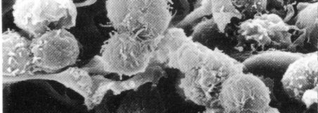 β 1 2 α 2 نتاي ج الهجرة الكهرباي