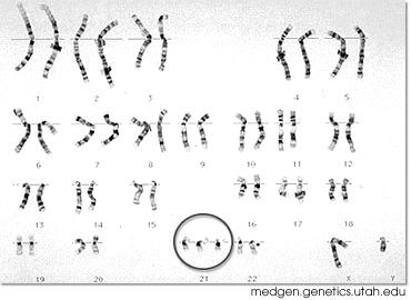 1.5.74. Ο παρακάτω πίνακας περιέχει πληροφορίες για το γενετικό υλικό τεσσάρων ιών. Τι είδους γενετικό υλικό περιέχει ο καθένας; ΙΟΣ Α ΙΟΣ Β ΙΟΣ Γ ΙΟΣ Δ Φ.φ.δ 3.000 3.119 3.600 2.859 Αδενίνες 750 1.
