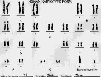 Σε κάθε ένα από τα τρία μόρια DNA αφού μετρήσετε των αριθμό των βάσεων (νουκλεοτιδίων) και των αντίστοιχων φωσφοδιεστερικών δεσμών που συνδέουν τα νουκλεοτίδια(συμβολίζεται με παύλα ανάμεσα σε δύο