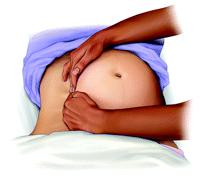אסטמה : במטופלים עם דום לב ונשימה על רקע התקף אסטמה קשה - מומלץ להנשים בקצב מופחת של 2-2 נשימות בדקה ובנפח מופחת. הריון : מיקום העיסויים מעט גבוה יותר ע"פ עצם החזה.