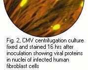 DEAFF test for CMV (Virology