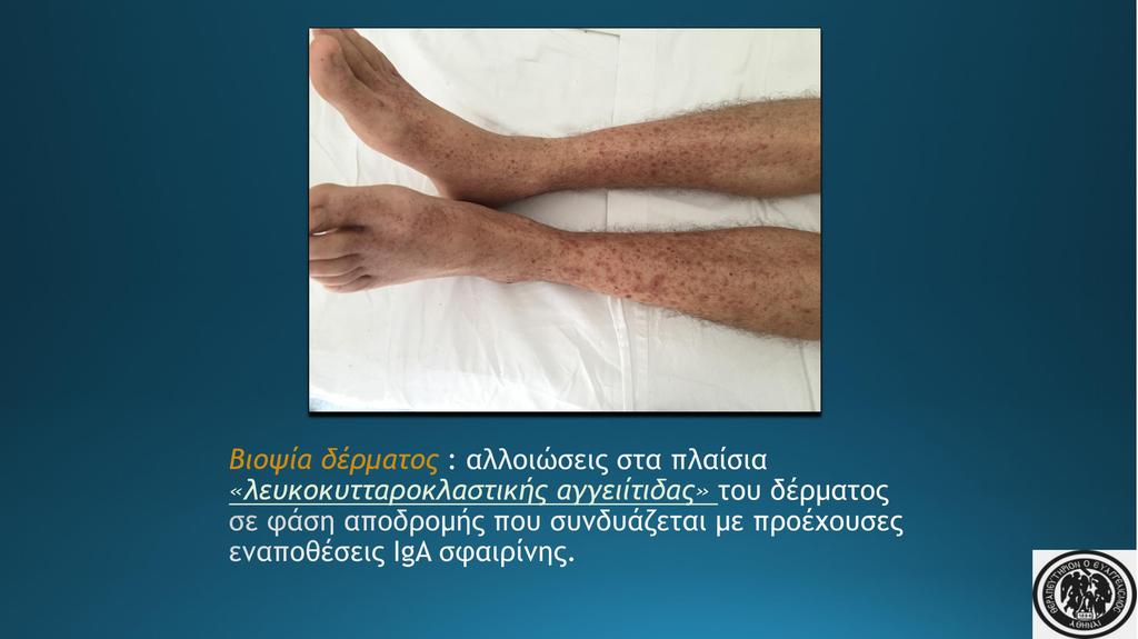 Βιοψία δέρματος