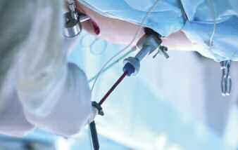 th INTERNATIONAL FORUM FOR MEDICAL STUDENTS & JUNIOR DOCTORS - WORKSHOPS WK6: Laparoscopic Surgery skills Duration: hours Trainers: Dimitrios Theodorou (coordinator), Andreas Larentzakis, Vasileios