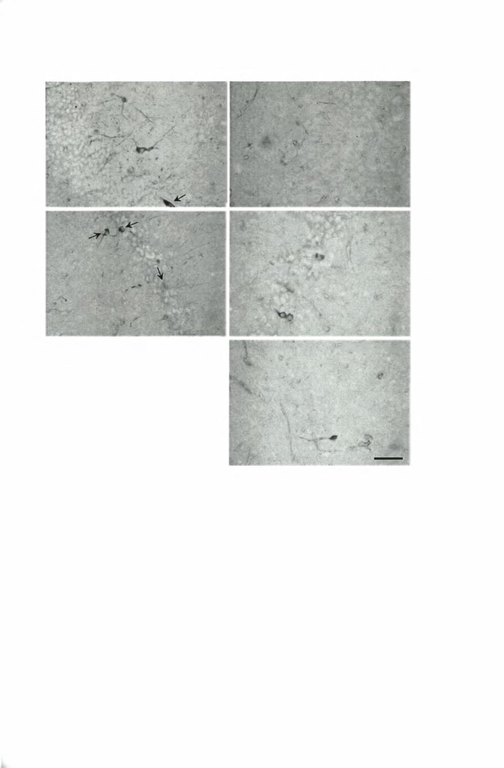 V Α ί,ψ \.. 4 DGm/g 2 Λ. ' ν 'Ρ ' J X %. V Αηοτελέσυατα DGpd <* CA2 ί $ \, y Η 4 % DG-CA2r3m/l ST \ Εικόνα 23.