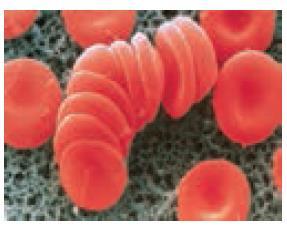 نکته : گلبول های قرمز در بازه ی کوچکی از ph کارایی دارند. خون مایعی حیاتی و معجونی از مواد شیمیایی گوناگون است.